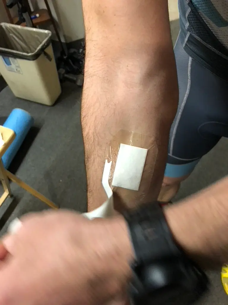 Positioning the Tegaderm + pad dressing on the inner forearm