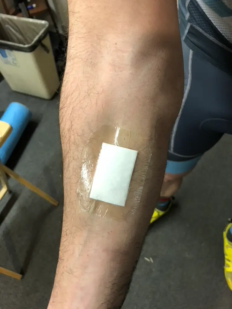 Tegaderm + pad fully applied and sealed to the forearm