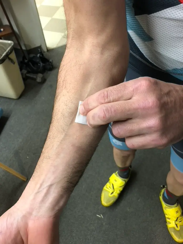 Cleaning the anterior forearm with an alcohol swab in concentric circles