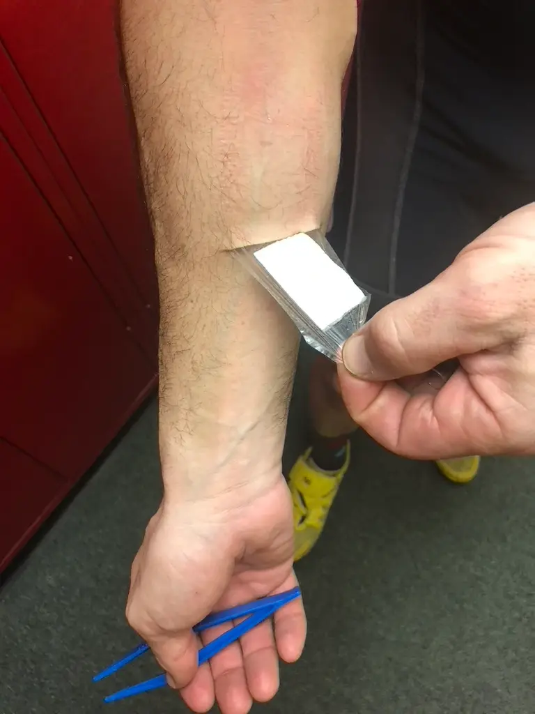 Grasping the corner of the gauze pad with tweezers