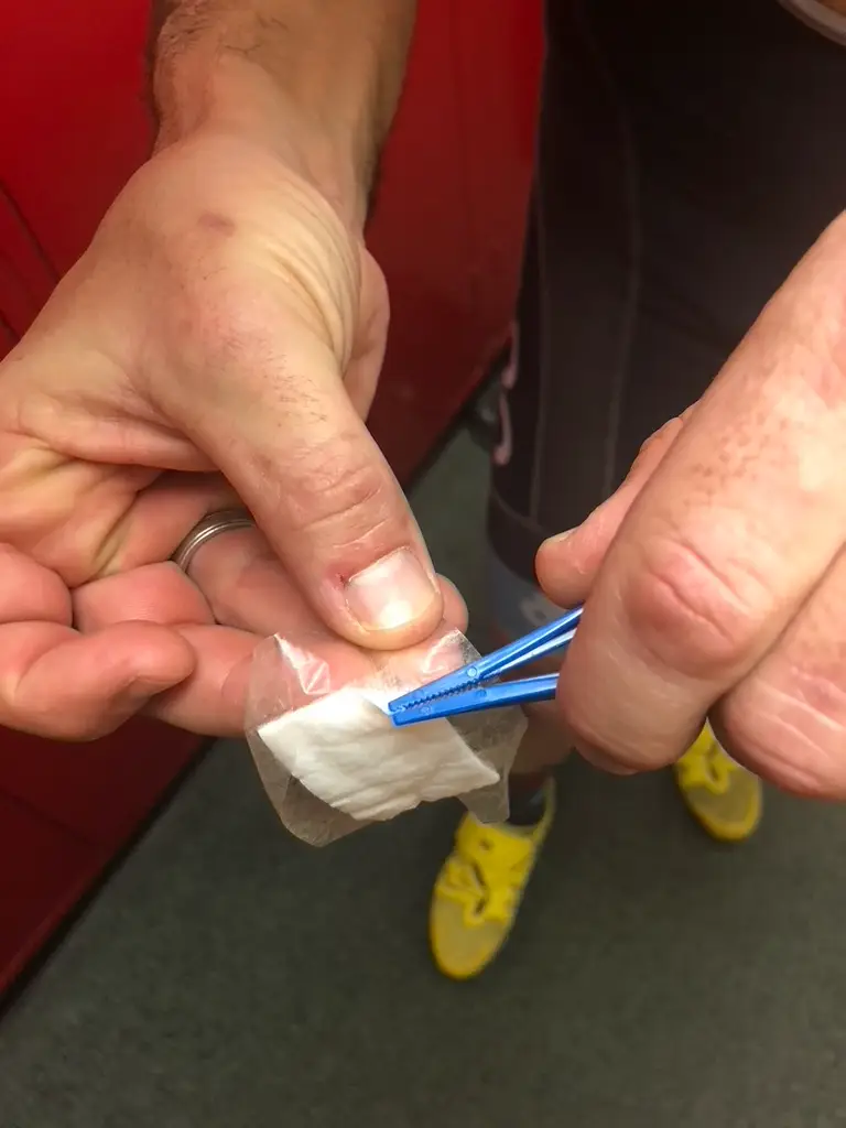 Tweezers separating the pad from the adhesive backing